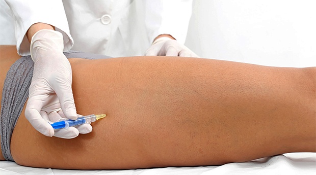 mesoterapia
