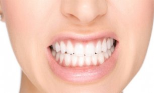 Corrige o problema de Ranger os Dentes nos Aliados! 