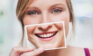 Sessão de Avaliação de Gengivas e Dentes com Tratamento nos Aliados!
