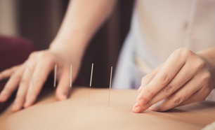 Acupunctura para Alívio da Tensão Pré-Menstrual!